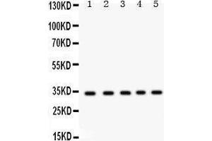 RCAS1 anticorps  (AA 31-213)