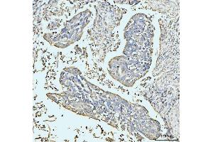 IHC analysis of GRPEL1 using anti-GRPEL1 antibody (ABIN7602643). (GRPEL1 antibody  (AA 90-217))