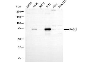 Western blotting analysis using PADI2 antibody (ABIN7799756).