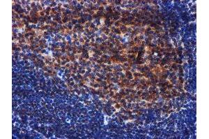 Image no. 2 for anti-PIH1 Domain Containing 2 (PIH1D2) (AA 1-315) antibody (ABIN1490740) (PIH1D2 antibody  (AA 1-315))