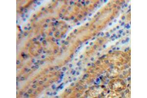 IHC-P analysis of kidney tissue, with DAB staining. (Tyrosine Hydroxylase antibody  (AA 34-301))