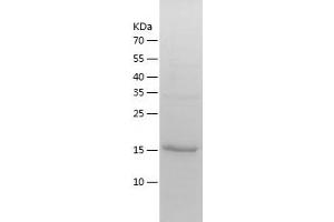 TPRKB Protein (AA 1-175) (His tag)