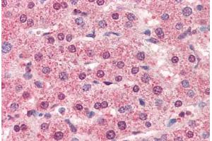 Human Liver (formalin-fixed, paraffin-embedded) stained with CTSL1 antibody ABIN364356 at 5 ug/ml followed by biotinylated anti-mouse IgG secondary antibody ABIN481714, alkaline phosphatase-streptavidin and chromogen. (Cathepsin L antibody  (AA 114-333))