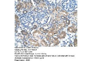 Immunohistochemistry (IHC) image for anti-Solute Carrier Family 38 Member 4 (SLC38A4) (Middle Region) antibody (ABIN310355) (SLC38A4 antibody  (Middle Region))
