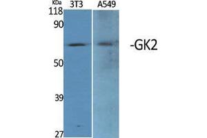 Western Blot (WB) analysis of specific cells using GK2 Polyclonal Antibody.
