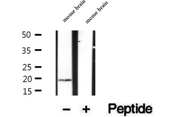 CPLX2 antibody  (Internal Region)