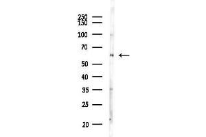 anti-Protein Kinase C and Casein Kinase Substrate in Neurons 2 (PACSIN2) (C-Term) antibody