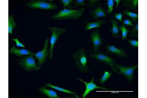 Immunofluorescence of purified MaxPab antibody to CHD9 on HeLa cell. (CHD9 antibody  (AA 1-119))