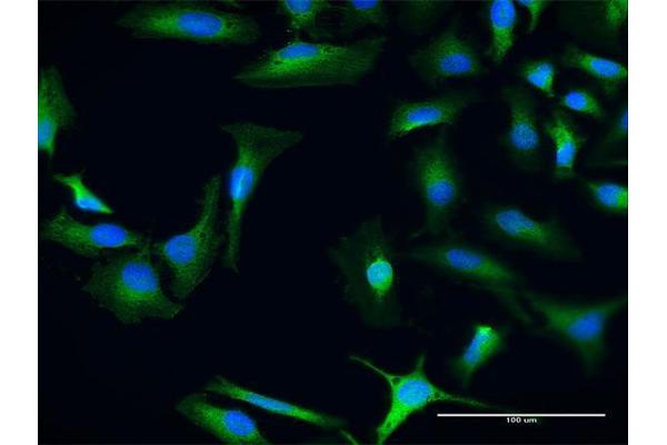 CHD9 antibody  (AA 1-119)