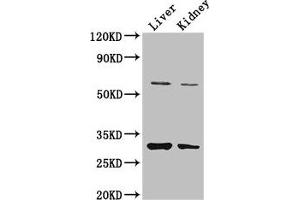 Western Blot Positive WB detected in: Mouse liver tissue, Mouse kidney tissue All lanes: PANK2 antibody at 3. (PANK2 antibody  (AA 437-490))