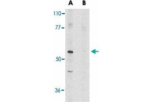 Western blot analysis of Ripk3 in mouse NIH/3T3 whole cell lysate in the absence (A) or presence (B) of blocking peptide with Ripk3 polyclonal antibody  at 1 ug/mL . (RIPK3 antibody  (AA 473-486))