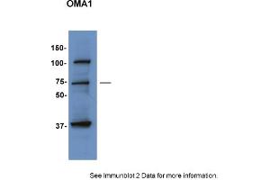 Sample Type: HepG2 cellsPrimary Dilution: 1:1000Secondary Antibody: anti-Rabbit TBST with 5% BSASecondary Dilution: 1:5000Image Submitted by: Hana SabicUniversity of Utah (OMA1 antibody  (Middle Region))