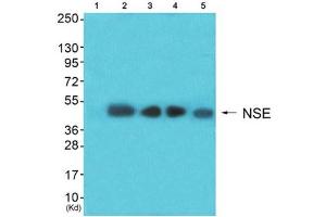 Western Blotting (WB) image for anti-Enolase 2 (Gamma, Neuronal) (ENO2) (C-Term) antibody (ABIN1848702) (ENO2/NSE antibody  (C-Term))