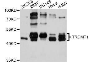 Western blot analysis of extracts of various cell lines, using TRDMT1 antibody (ABIN4905485) at 1:1000 dilution. (Dnmt2 antibody)