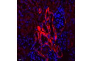 Immunofluorescence of paraffin embedded mouse kidney using SLC7A8 (ABIN7074503) at dilution of 1:300 (400x lens) (LAT2 antibody)