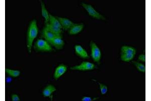 Immunofluorescent analysis of Hela cells using ABIN7174611 at dilution of 1:100 and Alexa Fluor 488-congugated AffiniPure Goat Anti-Rabbit IgG(H+L) (GALE antibody  (AA 1-348))