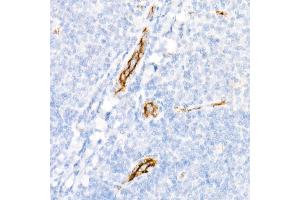 Immunohistochemistry of paraffin-embedded Human tonsil using von Willebrand factor (VWF) antibody (ABIN7271339) at dilution of 1:800 (40x lens). (VWF antibody)