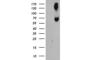 HEK293T cells were transfected with the pCMV6-ENTRY control (Left lane) or pCMV6-ENTRY ACSM5 (Right lane) cDNA for 48 hrs and lysed. (ACSM5 antibody)