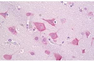 Anti-CSNK1E antibody IHC staining of human brain, cortex neurons. (CK1 epsilon antibody  (AA 276-325))