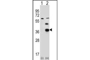 Western blot analysis of PDXK (arrow) using rabbit polyclonal PDXK Antibody (H13) (ABIN391110 and ABIN2841241). (PDXK antibody  (N-Term))