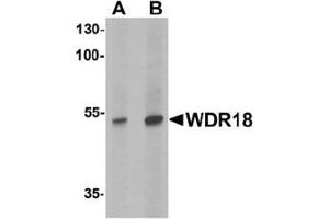 Western blot analysis of WDR18 in rat lung tissue lysate with WDR18 antibody at (A) 0.