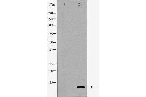 Western blot analysis of Hepg2 whole cell lysates, using SNRPE Antibody. (SNRPE antibody)