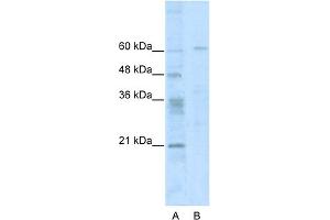WB Suggested Anti-ZNF192 Antibody Titration:  0.