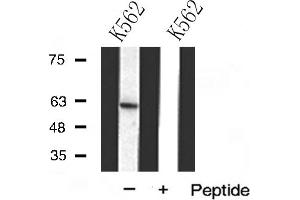 Western blot analysis of DCT(TRP2) expression in K562 cells (DCT antibody  (N-Term))