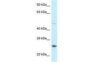 Image no. 1 for anti-Heterogeneous Nuclear Ribonucleoprotein F (HNRNPF) (AA 328-377) antibody (ABIN6747978) (HNRNPF antibody  (AA 328-377))