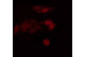 ABIN6275228 staining  HuvEc cells by IF/ICC.