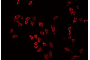 ABIN6266494 staining HeLa by IF/ICC. (MST1R antibody  (C-Term))