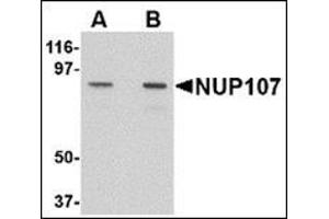 Western blot analysis of NUP107 in A549 cell lysate with this product at (A) 1 and (B) 2 μg/ml. (NUP107 antibody  (C-Term))