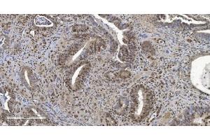 IHC analysis of HP1 alpha/CBX5 using anti-HP1 alpha/CBX5 antibody (ABIN7599057). (CBX5 antibody  (AA 1-191))