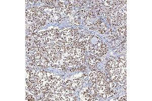 IHC analysis of TRMT61A using anti-TRMT61A antibody (ABIN7599220). (TRMT61A antibody  (AA 1-289))