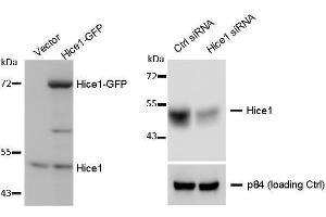 WB Image WB to detect cellular Hice1 and Hice1-GFP expressed in human osteosarcoma U2OS cells (left image), and Hice1 upon siRNA treatment (right image), using  at 1:1000 dilution. (NYS48/HAUS8 antibody)