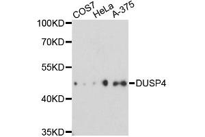 Western blot analysis of extracts of various cell lines, using DUSP4 antibody. (DUSP4 antibody)