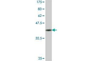 Western Blot detection against Immunogen (37. (BLVRB antibody  (AA 107-206))