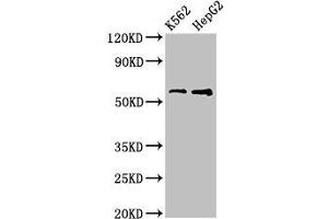 Western Blot Positive WB detected in: K562 whole cell lysate, HepG2 whole cell lysate All lanes: FSCN1 antibody at 3. (Fascin antibody  (AA 2-187))