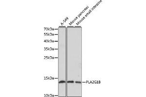 Western blot analysis of extracts of various cell lines, using PLG1B antibody (ABIN6129428, ABIN6145724, ABIN6145725 and ABIN6221143) at 1:1000 dilution.