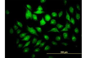 Immunofluorescence of monoclonal antibody to PYCRL on HeLa cell. (PYCRL antibody  (AA 32-131))