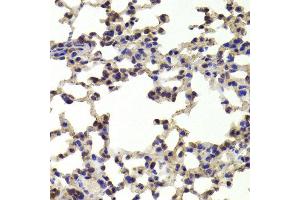 Immunohistochemistry of paraffin-embedded Mouse lung using HOXB1 antibody at dilution of 1:100 (x400 lens).