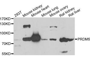 Western blot analysis of extracts of various cell lines, using PRDM5 antibody (ABIN5975510) at 1/1000 dilution.