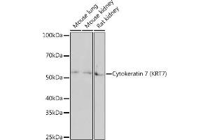 Western blot analysis of extracts of various cell lines, using Cytokeratin 7 (KRT7) (KRT7) Rabbit mAb  at 1:1000 dilution. (Cytokeratin 7 antibody)