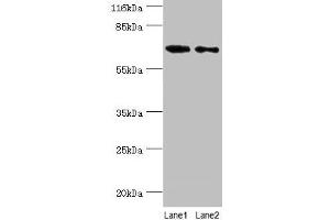Western blot All lanes: GALNT14 antibody at 2 μg/mL Lane 1: Rat gonad tissue Lane 2: Mouse kidney tissue Secondary Goat polyclonal to rabbit IgG at 1/10000 dilution Predicted band size: 65, 61, 62 kDa Observed band size: 65 kDa (GALNT14 antibody  (AA 1-552))