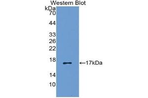 Detection of Recombinant RANTES, Canine using Polyclonal Antibody to Regulated On Activation In Normal T-Cell Expressed And Secreted (RANTES) (CCL5 antibody  (AA 24-91))