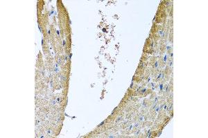 Immunohistochemistry of paraffin-embedded mouse heart using COX5B antibody at dilution of 1:100 (x40 lens).