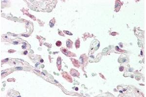 Human Lung (formalin-fixed, paraffin-embedded) stained with TNFSF13 antibody ABIN461884 at 10 ug/ml followed by biotinylated goat anti-rabbit IgG secondary antibody ABIN481713, alkaline phosphatase-streptavidin and chromogen. (TNFSF13 antibody  (Extracellular Domain))
