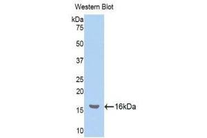Western Blotting (WB) image for anti-Nucleophosmin (Nucleolar phosphoprotein B23, Numatrin) (NPM1) (AA 20-154) antibody (ABIN1175781) (NPM1 antibody  (AA 20-154))