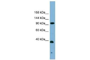 ERCC4 antibody used at 1 ug/ml to detect target protein.