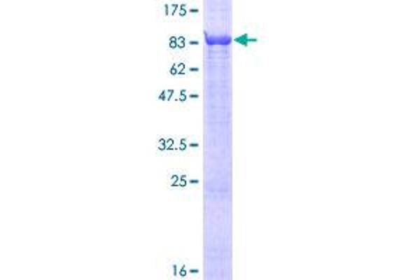 EVC Protein (AA 1-535) (GST tag)